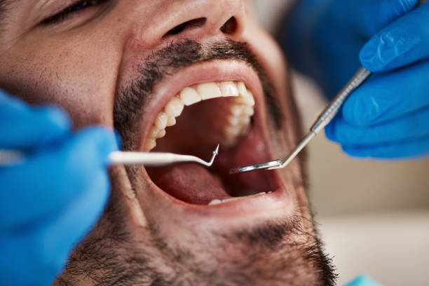 Best Urgent Tooth Repair  in Ponderay, ID